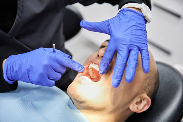 Best Knocked-Out Tooth Emergency  in Concordia, MO